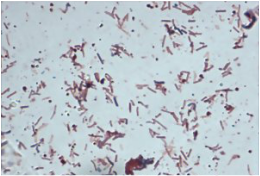 This is a microscope image of bacterial culture taken from the surface of Horsetooth Reservoir in Fort Collins, Colorado in March 2016. The image is a component of her senior thesis which looks at the ecology of Horsetooth Reservoir.